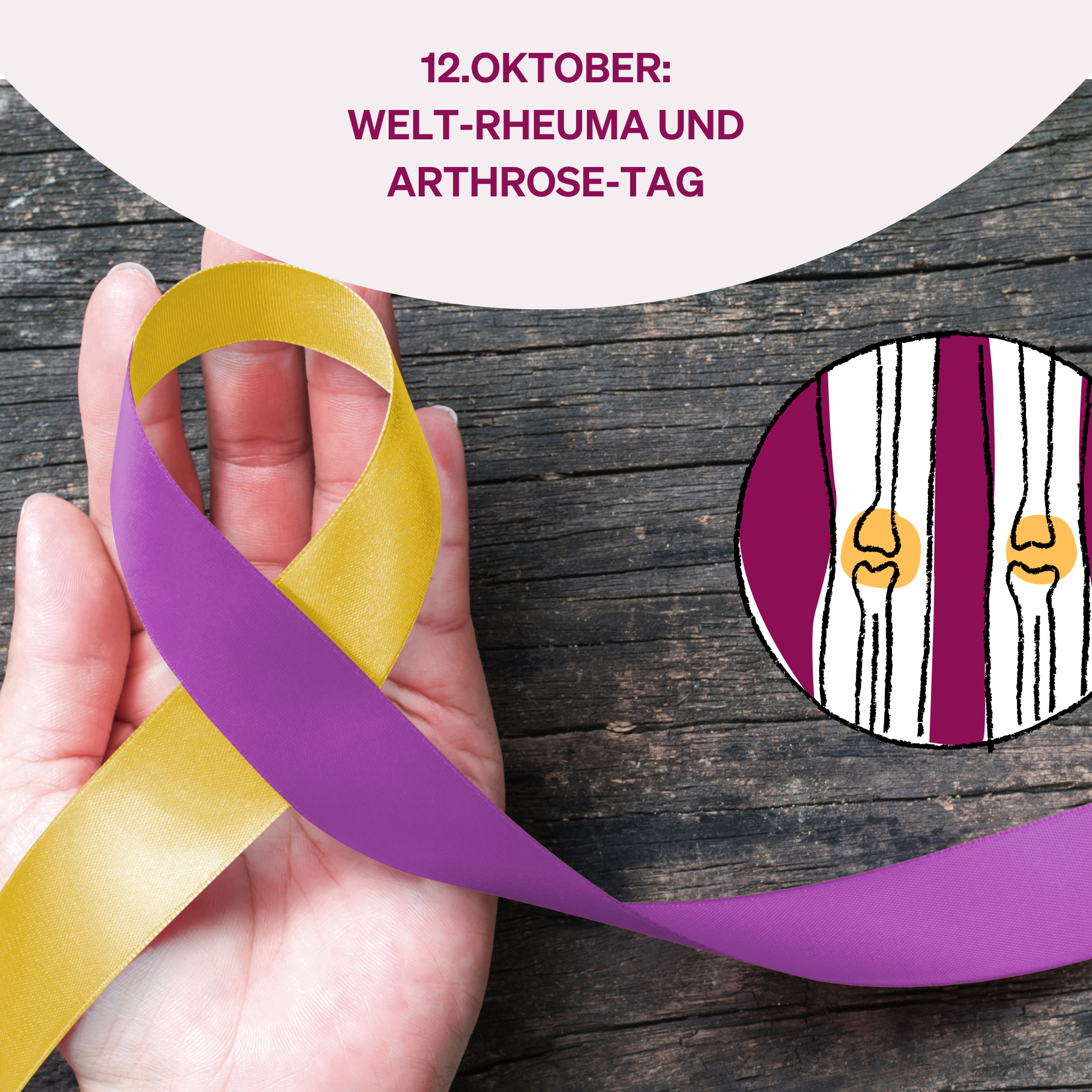 Am 12. Oktober ist Welt-Rheuma und Arthrose-Tag: Ein Blick auf die molekularen Ursachen und wissenschaftlichen Fortschritte